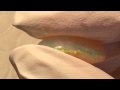 7 Karat Welo Regenbogen Ribbon Opal