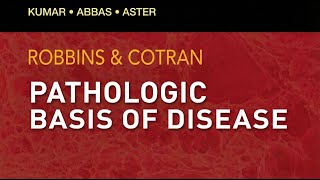 Robbins & Cotran Pathology  | Chapter-4 | Hemodynamic Disorders, Thromboembolic Disease & Shock