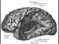 Neurocardiology Wikipedia Audio Article