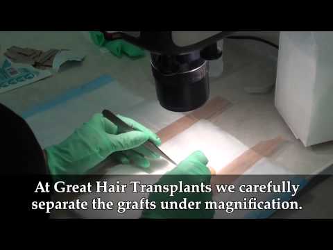 How Many Hair Grafts Will I Need? Video