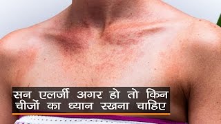 Sun Allergy Skin Care Cover Body In Hindi