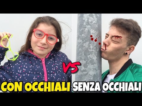 Trucco di lentiggine capelli rossi Ci sono state macchie ruvide scure su pelle