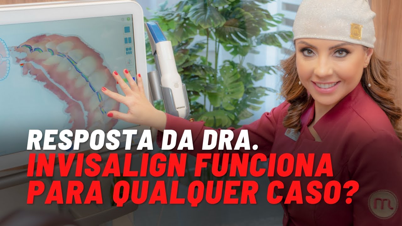 Invisalign - O que é, como funcionam e corrigem os dentes mesmo?
