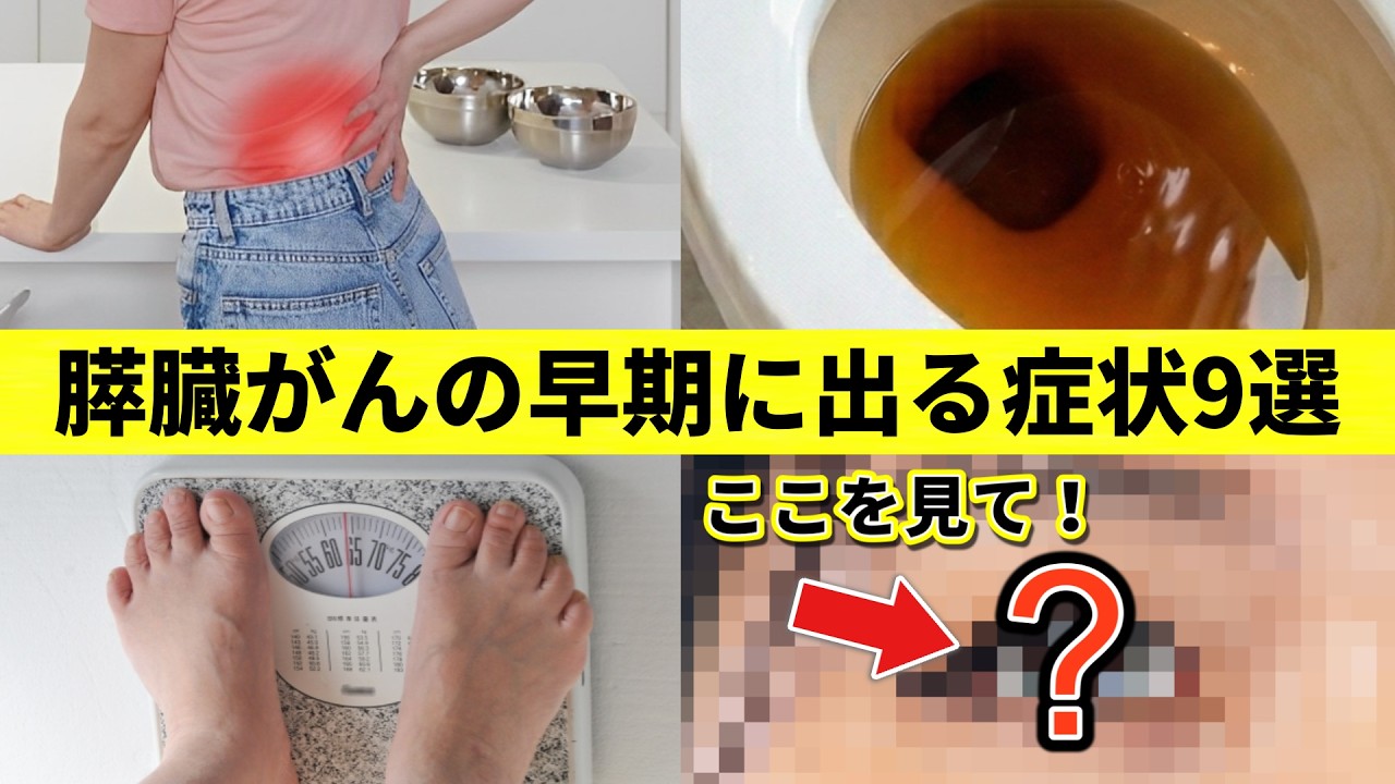 【世界一恐ろしい】膵臓がんの超意外な9個のサインと、膵臓がんになりやすい人の特徴5選！