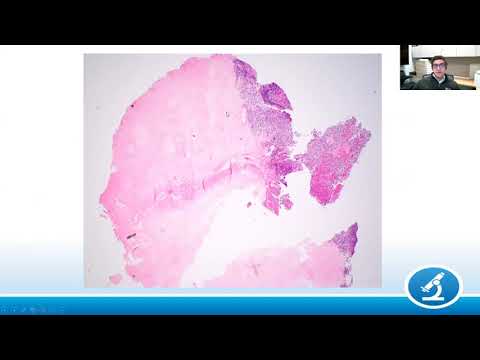 AANP Teaching Rounds - September 27 - Infectious Diseases of the Central Nervous System