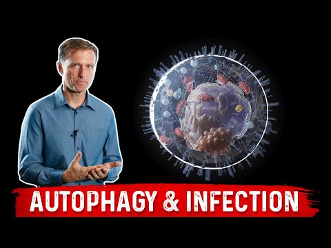 How to Overcome Adrenal Stress with Intermittent Fasting – Dr Berg