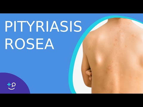 Pityriasis Rosea - Daily Do's of Dermatology