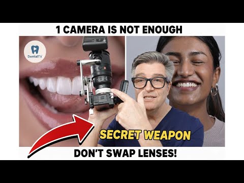 Full Frame or APS-C? Dental Photographers Are Split on This