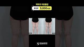 허벅지 부피 확 줄어드니까 다리가 길어보임