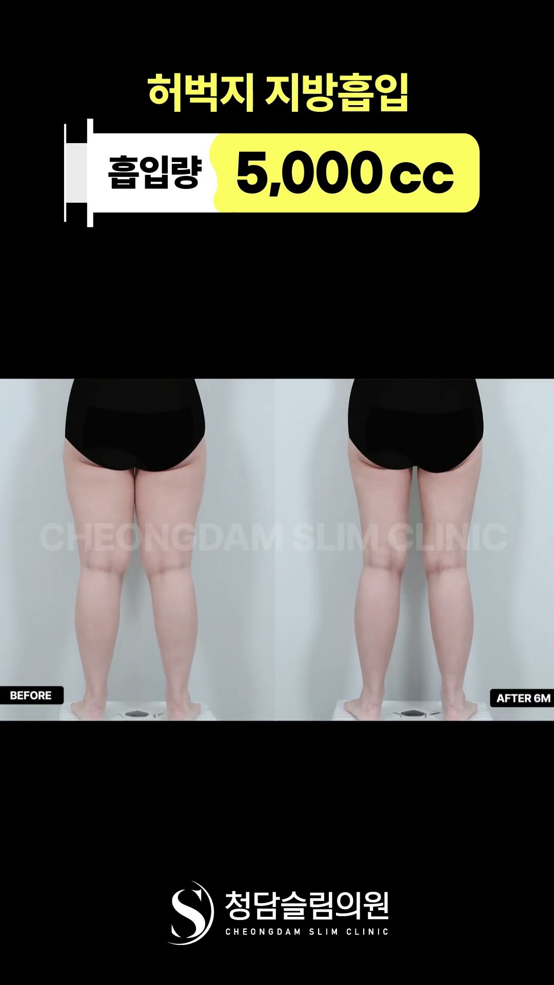 허벅지 부피 확 줄어드니까 다리가 길어보임