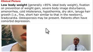 (28) Anorexia Nervosa    #usmle #internal_medicine #cme  #ecg #كورسات_باطنة #محاضرات_باطنة #medical
