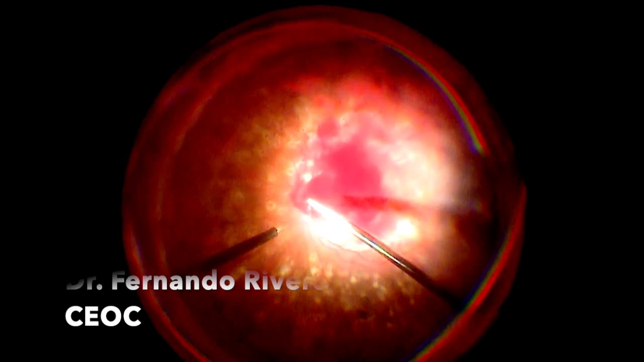 Juan Fernando Rivero Prado-9