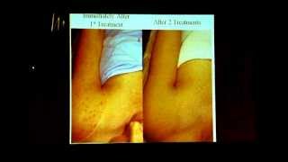 Midsota Skin and Laser Presents...