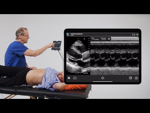 Using EPSS to Assess LV Function