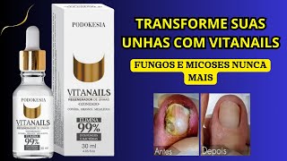 REGENERADOR DE UNHAS VITANAILS PODOKESIA. COMBATE FUNGOS E MICOSES NAS UNHAS, DEIXANDO FORTES, BELAS