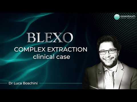 BLEXO clinical case — Micro and LongRoot extraction