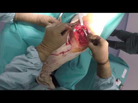 Gelatina per le recensioni articolazioni video Osteocondrosi di un reparto del collo dellutero di una sensazione di bruciore nella testa