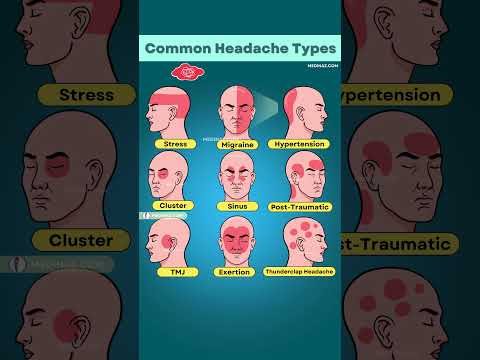 Which Headache Do You Have? 😣 Tension, Migraine, or Something Serious?