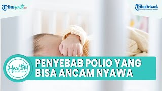 Kenali Penyebab Polio yang Bisa Menular hingga Alami Kelumpuhan, Termasuk Hindari Kontak Langsung