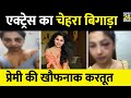 Anicka Vikhraman एक्ट्रेस का चेहरा बिगाड़ा प्रे�