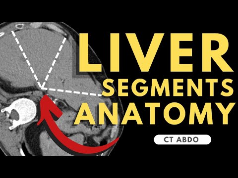 Liver Segments on CT scan | Radiology anatomy part 1 prep | Segmental Liver Anatomy CT