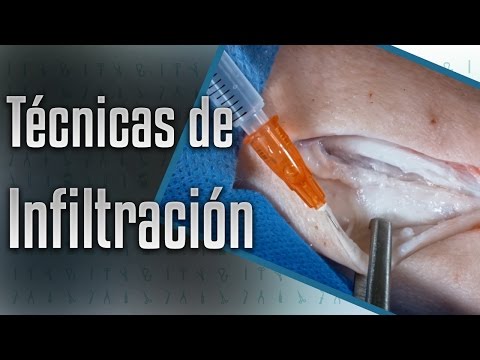 Depósitos de sal en los riñones y las articulaciones Inervación tobillo y suministro de sangre