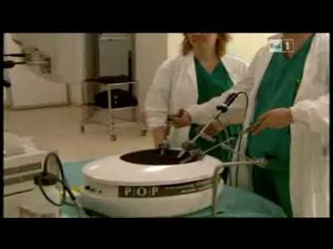 Come fare da soli una prostata dito massaggio Chirurgia Medicina prostatico