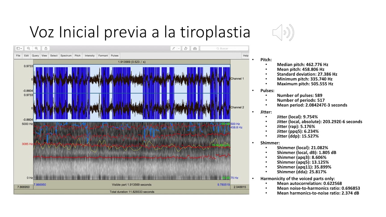 Raimundo Gutiérrez Fonseca-11