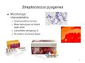 Streptococcus Pyogenes & Group B Strep: Infections, Complications & Diagnosis