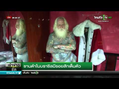 ผิวข้อศอกเป็นโรคสะเก็ดเงิน โรคสะเก็ดเงินน้ำมัน ICH