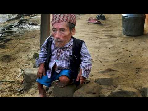 ТЫ НЕ ПОВЕРИШЬ!.Самый маленький человек на земле....