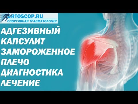 Народные средства лечение трохантерита тазобедренного сустава Как убрать остеофиты в шейном отделе
