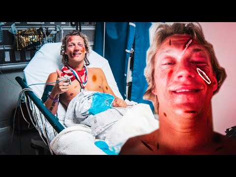 JUKKA's The WORST ACCIDENT (Dudesons)