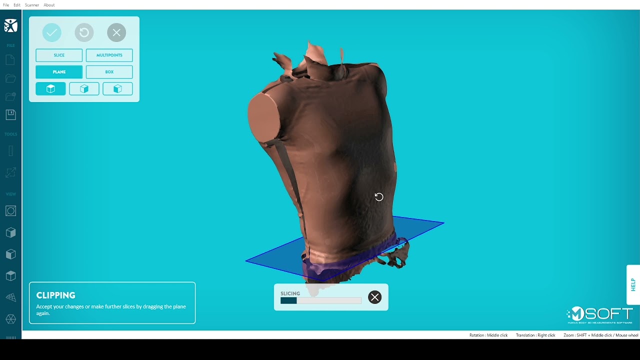 Two-sided torso scan processing in MSoft