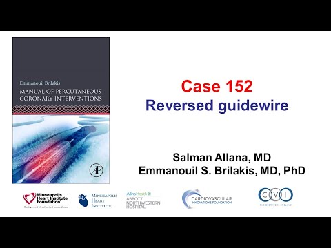 Case 152: PCI Manual - Reversed guidewire