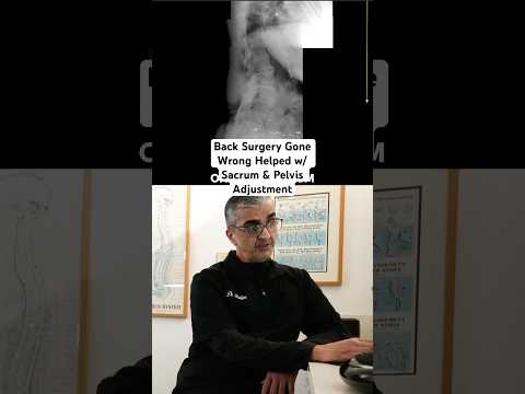 Back Surgery Gone Wrong Helped with Sacrum & Pelvis Adjustment #shorts ​⁠@DrRahim