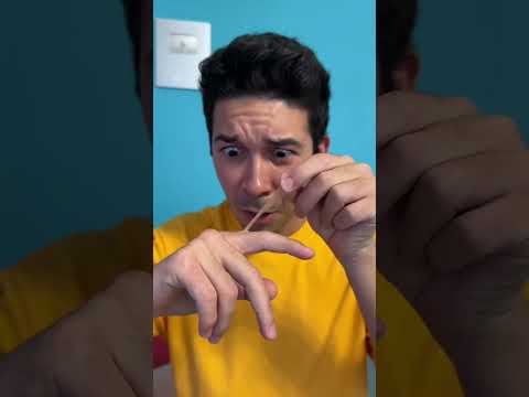 ERICK SI È FATTO MALE TOGLIENDO UNA PELLICINA… 💀#shorts