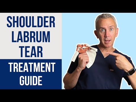 Die besten Lösungen bei Schulterlabrumrissen: Von Schmerzen zur Genesung