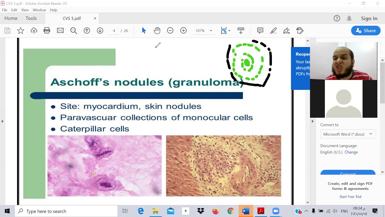 المعادلة الامريكية بالعربي TOXIC USMLE (CVS 5 ) - Dr Ibrahem Gamal  كورس د ابراهيم جمال