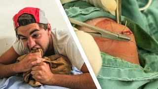 CRAZY SURFING INJURY!
