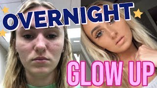 How to Get Prettier OVERNIGHT! (GLOW UP in 24 HOURS!)