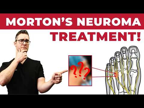 How To Treat Morton s Neuroma Foot Injection Research 2021