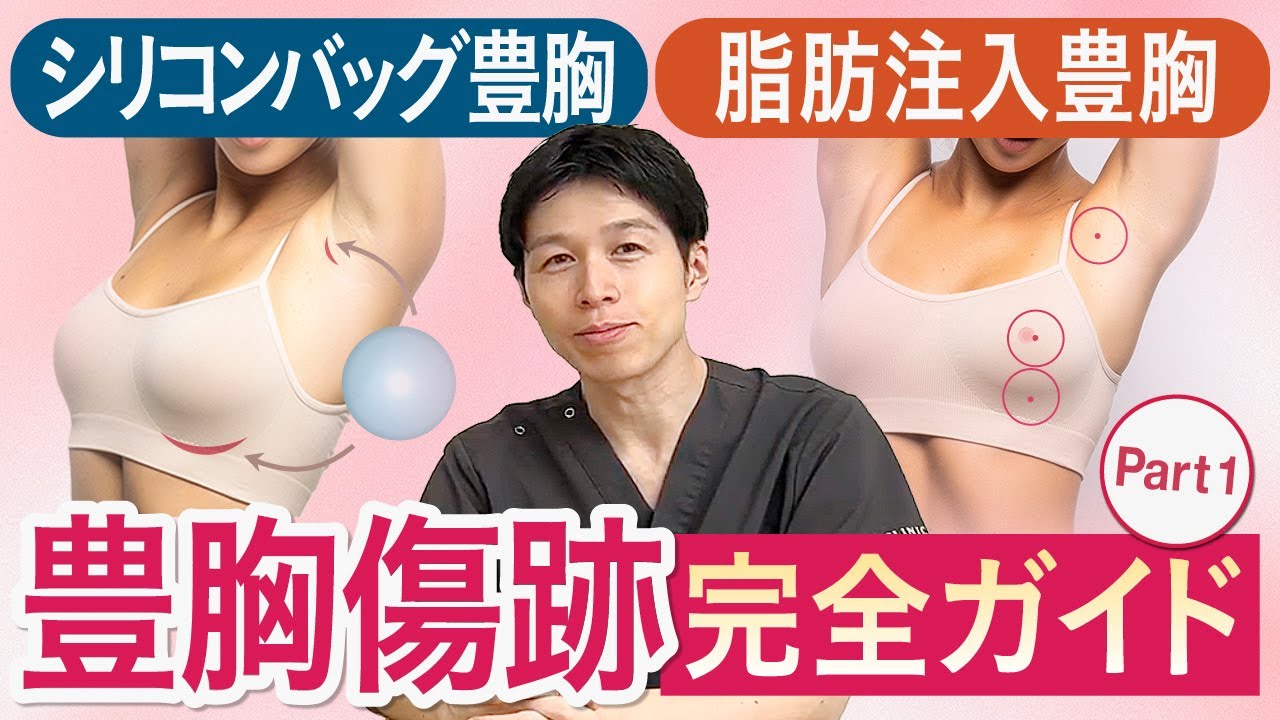 豊胸の傷跡はどこにできる？施術別の特徴と方法について徹底解説！