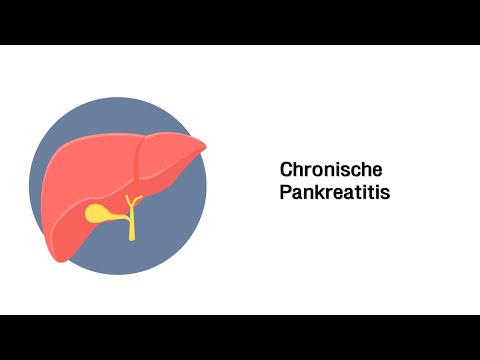 Chronische Bauchspeicheldrüsenentzündung (Chronische Pankreatitis)