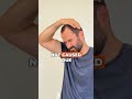3 Best Exercises to Alleviate Cervicogenic Headaches #shorts