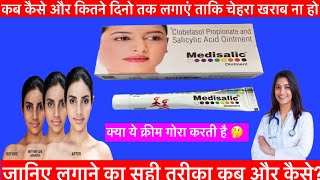 Medisalic cream ke fayde | Medisalic cream ointment uses in hindi | medisalic cream