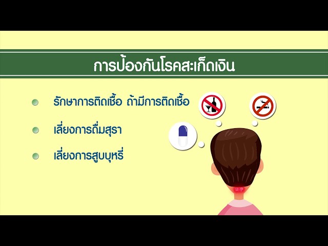 โรคผิวหนัง ป้องกันรักษาได้ ตอน โรคสะเก็ดเงิน | สารคดีสั้นให้ความรู้