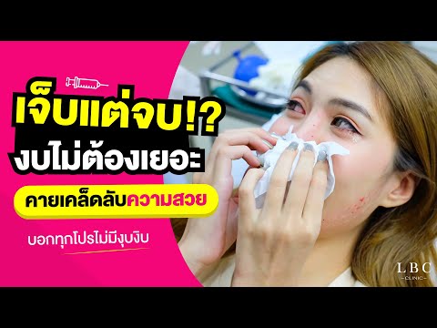 เมโสแฟต ยี่ห้อไหนดี