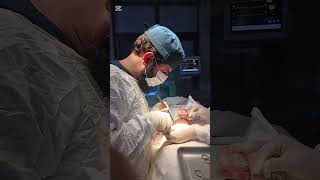 Open Appendectomy| step by step surgical procedure.