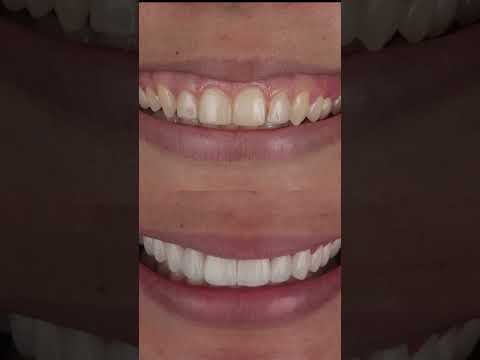 Frederico  Coelho-20